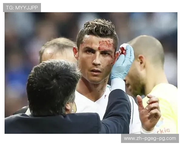 西甲联赛C罗流血比赛回顾